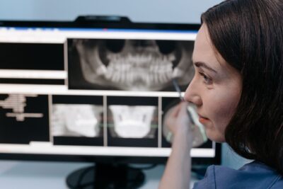 Antibiotiques chez le dentiste : ce que changent les nouvelles recommandations de la HAS